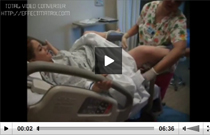Видео роды с эпидуральной анестезией.